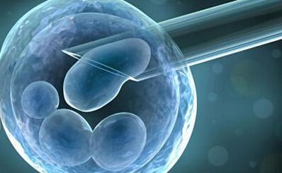 试管婴儿3号染色体（9号染色体臂间倒位可以做试管婴儿吗）